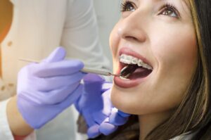 Read more about the article 4 Questions to Ask Your Local Dentist About Braces