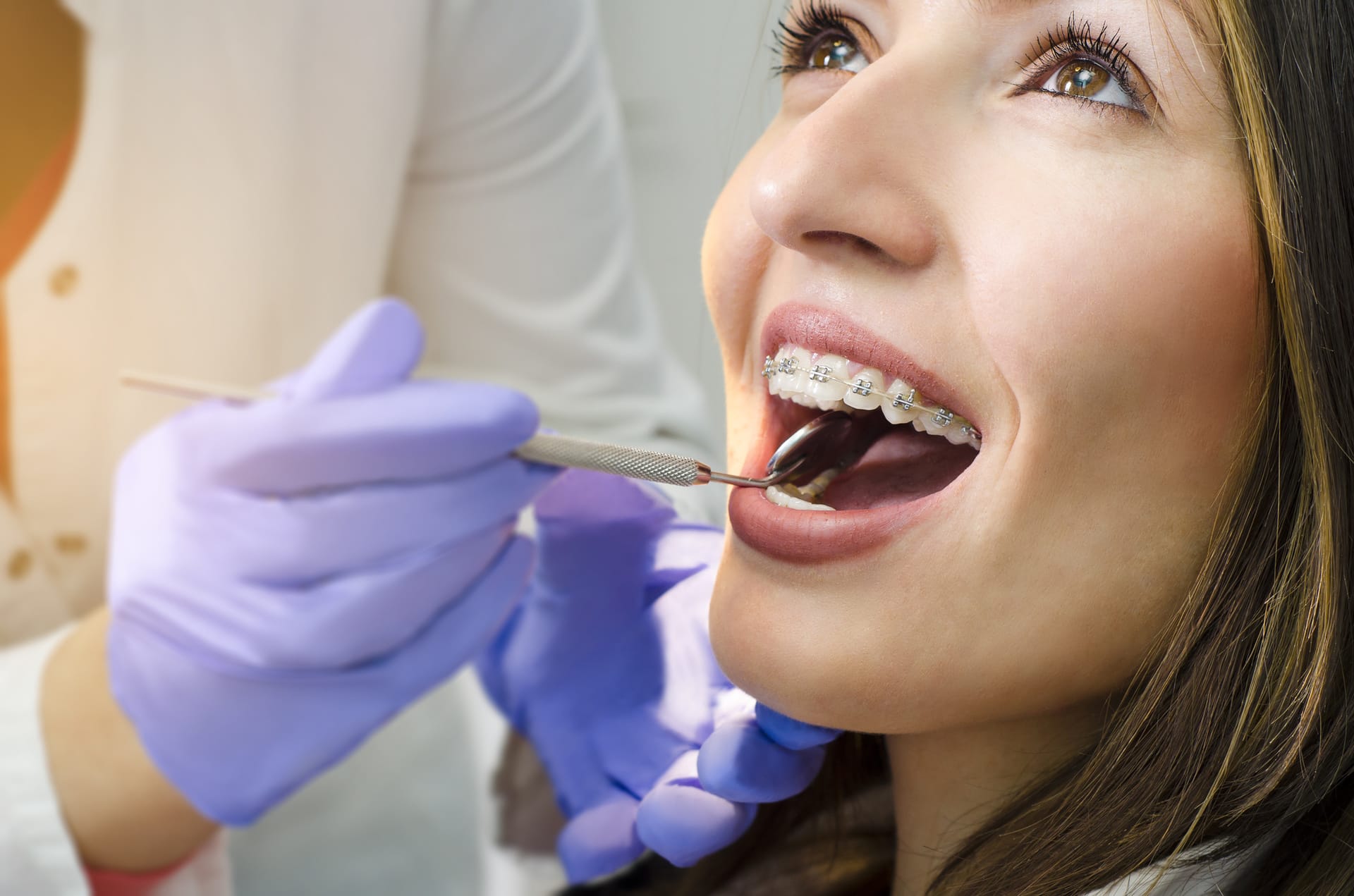 Read more about the article 4 Questions to Ask Your Local Dentist About Braces