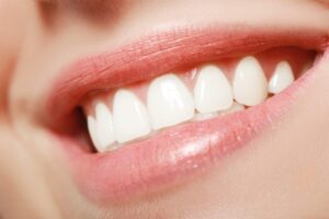 Read more about the article 4 Benefits of Having a Painless Dentist for Oral Health