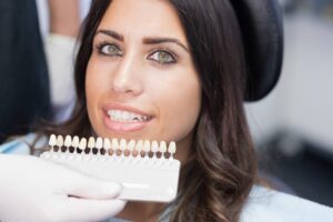 Read more about the article How Long Do Veneers Last on Average?