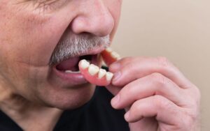 dental dentures